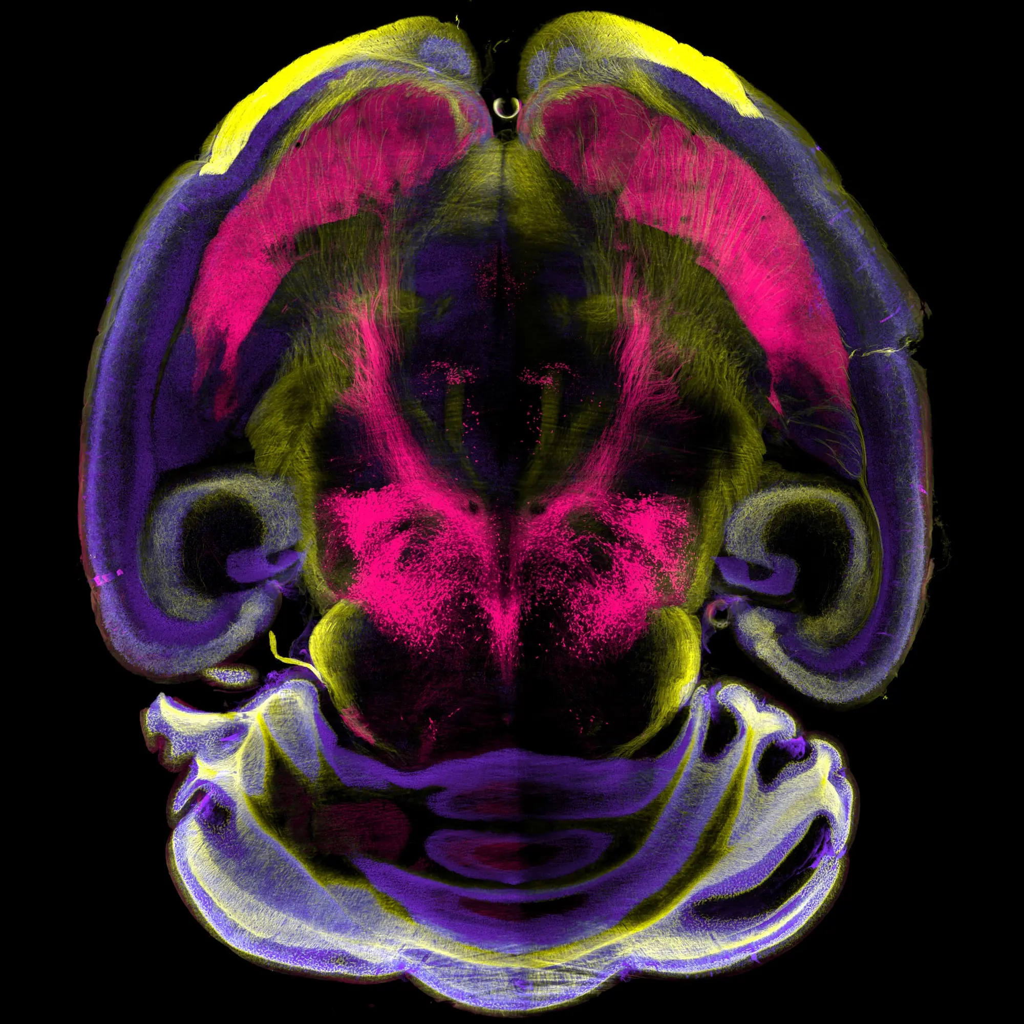 Intact mouse brain cleared using the MACS Deep Clearing Kit